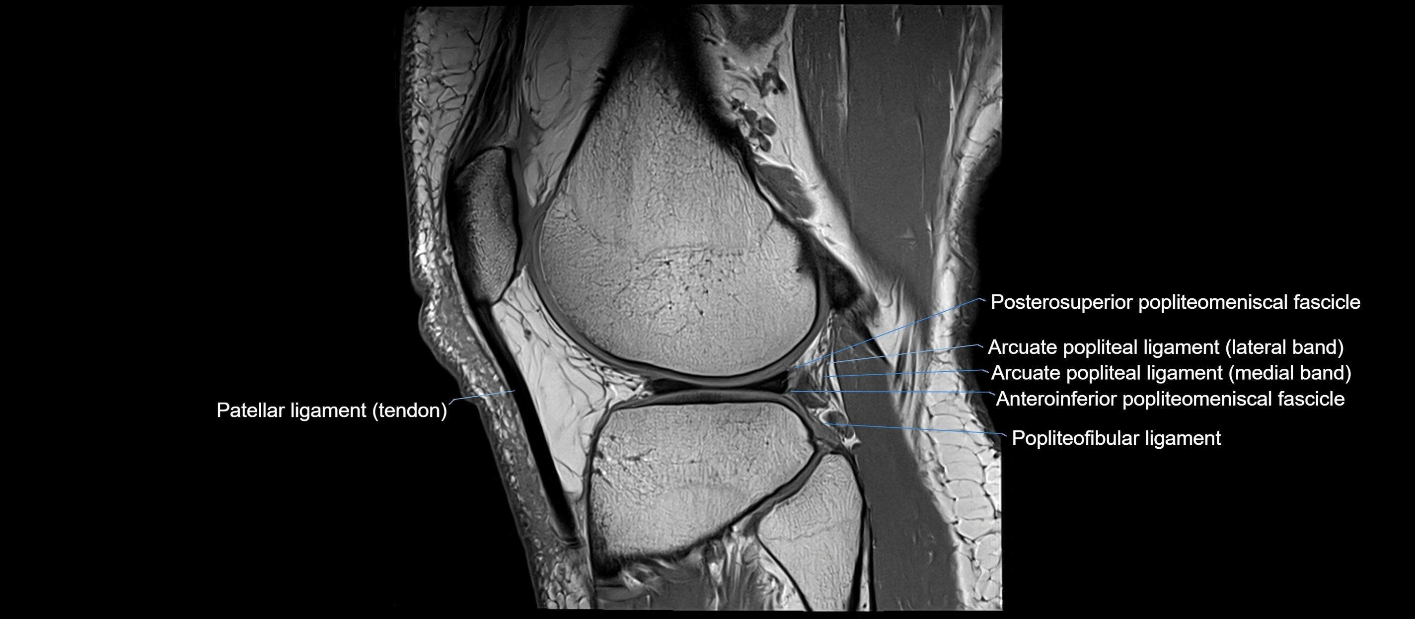 MRI sagittal  ligaments cross sectional anatomy 3T  radiology  image-img-00001-00036.webp